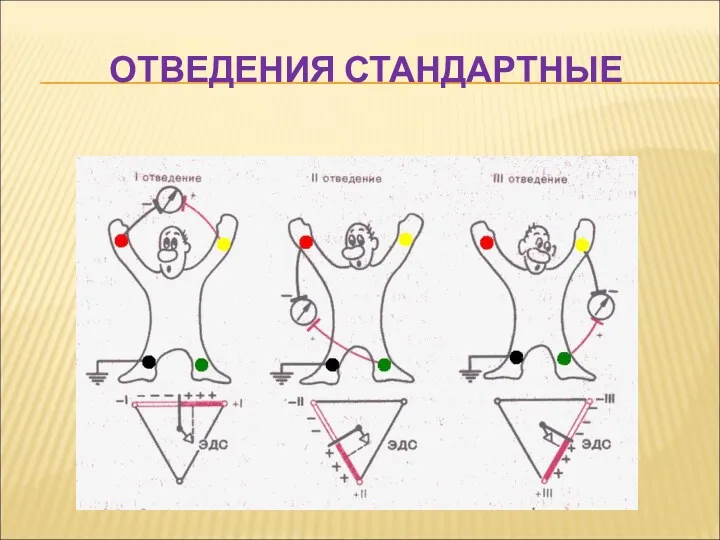 ОТВЕДЕНИЯ СТАНДАРТНЫЕ