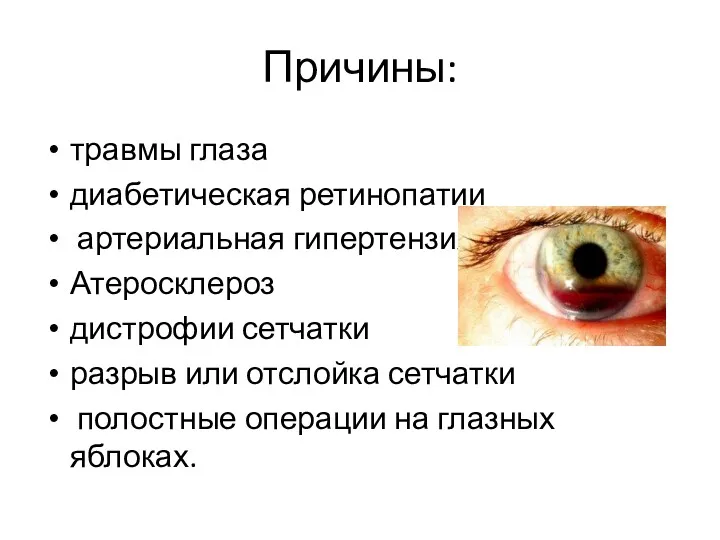 Причины: травмы глаза диабетическая ретинопатии артериальная гипертензия Атеросклероз дистрофии сетчатки