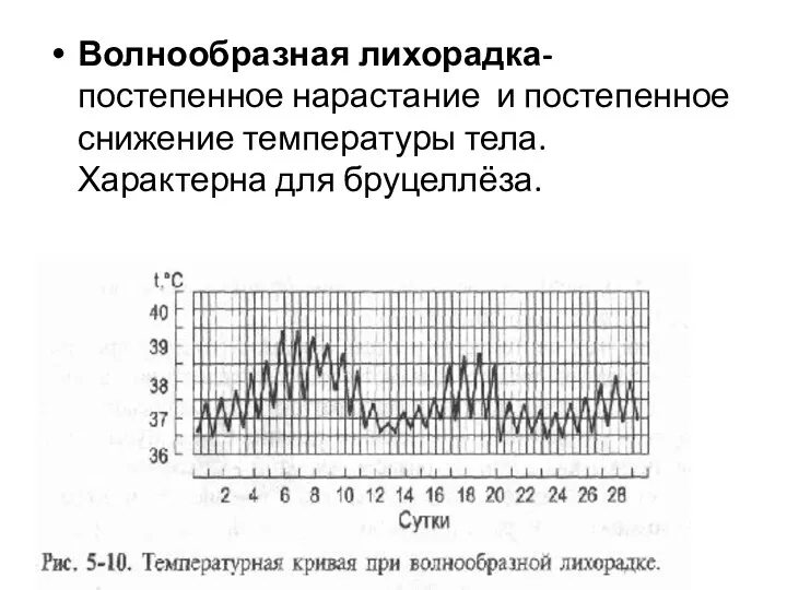 Волнообразная лихорадка- постепенное нарастание и постепенное снижение температуры тела. Характерна для бруцеллёза.