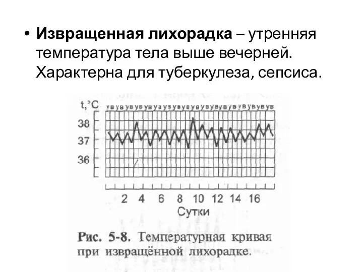 Извращенная лихорадка – утренняя температура тела выше вечерней. Характерна для туберкулеза, сепсиса.