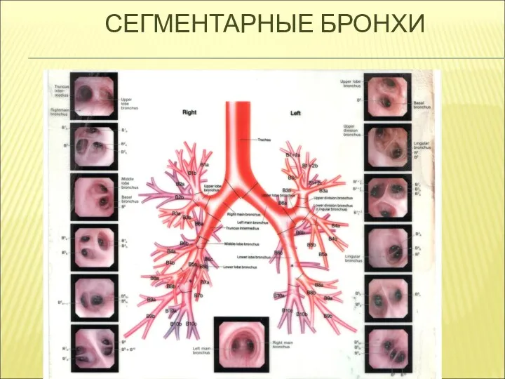 СЕГМЕНТАРНЫЕ БРОНХИ