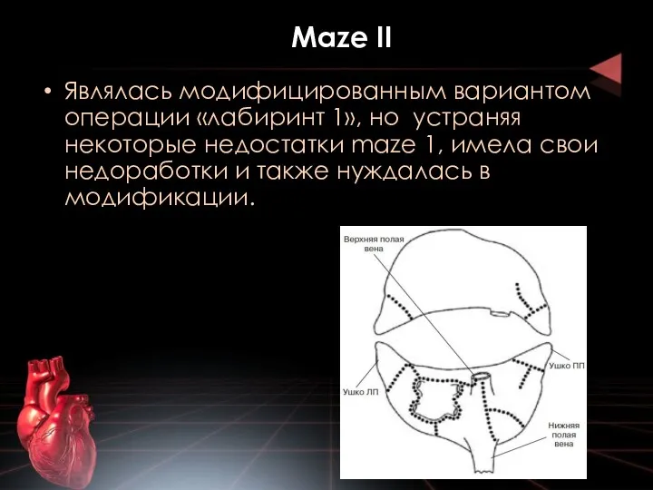 Maze II Являлась модифицированным вариантом операции «лабиринт 1», но устраняя некоторые недостатки maze