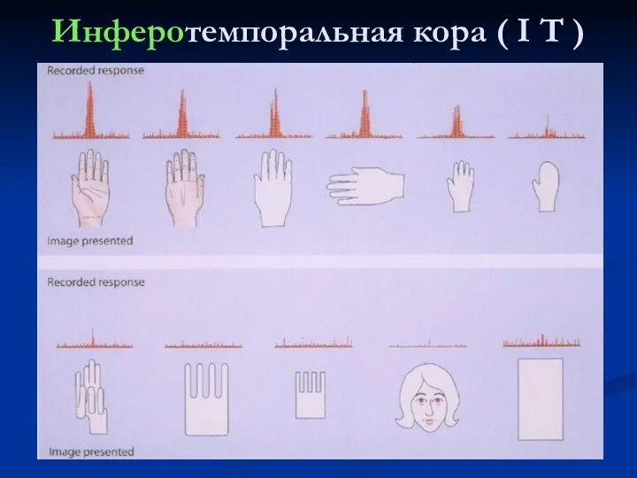 Инферотемпоральная кора ( I T )