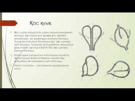 Қос қуық Өте сирек кездесетін даму аномалияларына жатады. Бұл кезде