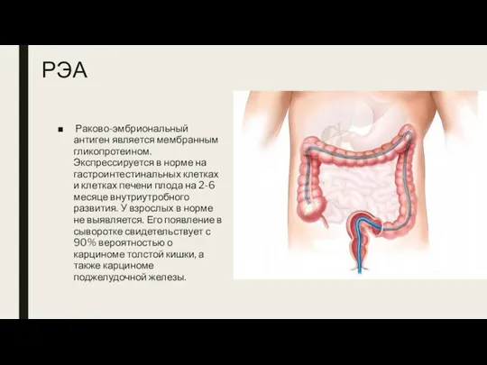 РЭА Раково-эмбриональный антиген является мембранным гликопротеином. Экспрессируется в норме на гастроинтестинальных клетках и