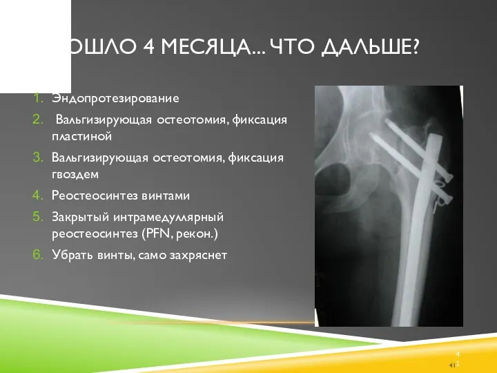 ПРОШЛО 4 МЕСЯЦА... ЧТО ДАЛЬШЕ? Эндопротезирование Вальгизирующая остеотомия, фиксация пластиной