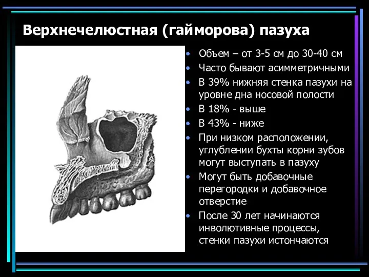 Верхнечелюстная (гайморова) пазуха Объем – от 3-5 см до 30-40