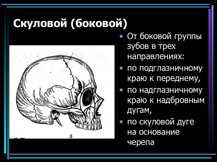 Скуловой (боковой) От боковой группы зубов в трех направлениях: по