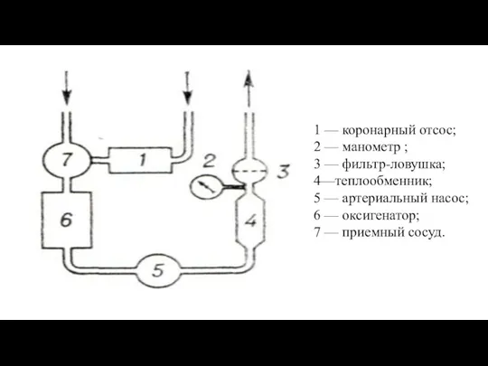 1 — коронарный отсос; 2 — манометр ; 3 —