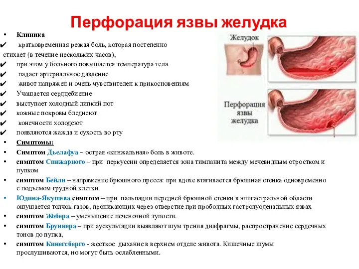 Перфорация язвы желудка Клиника кратковременная резкая боль, которая постепенно стихает