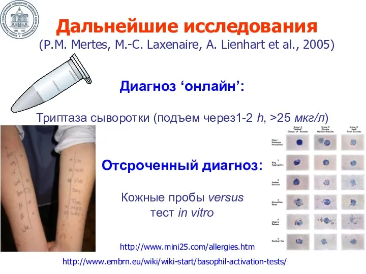 Диагноз ‘онлайн’: Триптаза сыворотки (подъем через1-2 h, >25 мкг/л) Отсроченный