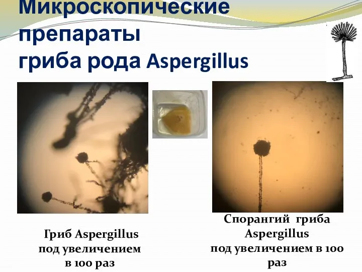 Микроскопические препараты гриба рода Aspergillus Гриб Aspergillus под увеличением в