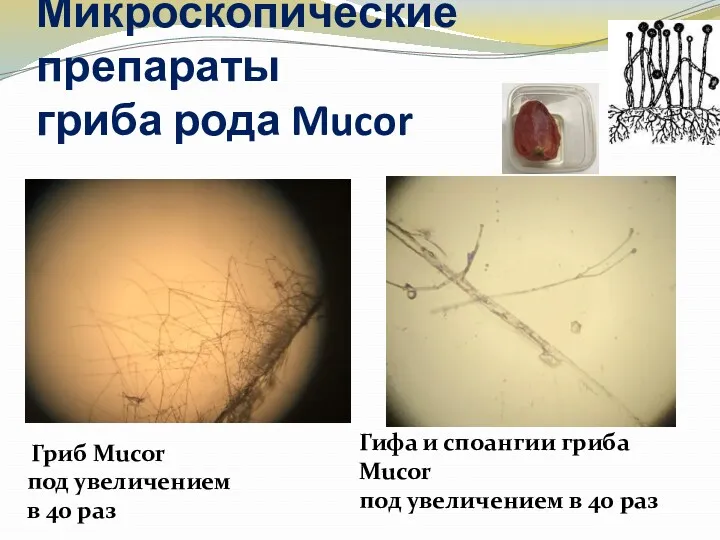 Микроскопические препараты гриба рода Mucor Гриб Mucor под увеличением в