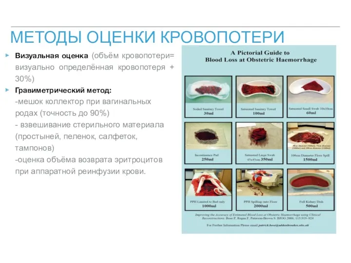 МЕТОДЫ ОЦЕНКИ КРОВОПОТЕРИ Визуальная оценка (объём кровопотери= визуально определённая кровопотеря