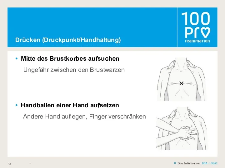 Drücken (Druckpunkt/Handhaltung) Mitte des Brustkorbes aufsuchen Ungefähr zwischen den Brustwarzen