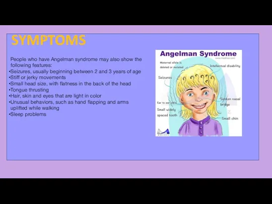 People who have Angelman syndrome may also show the following features: Seizures, usually