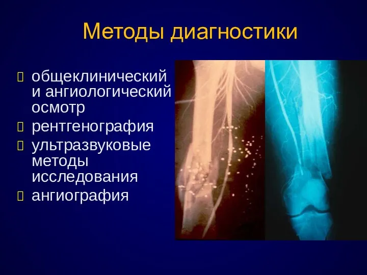 Методы диагностики общеклинический и ангиологический осмотр рентгенография ультразвуковые методы исследования ангиография