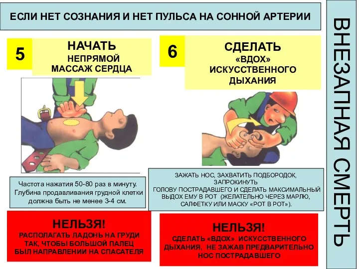 ЕСЛИ НЕТ СОЗНАНИЯ И НЕТ ПУЛЬСА НА СОННОЙ АРТЕРИИ 5