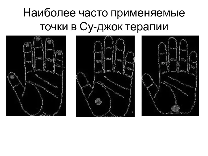 Наиболее часто применяемые точки в Су-джок терапии