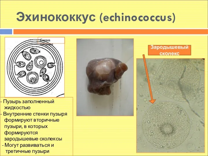 Эхинококкус (echinococcus) Зародышевый сколекс Пузырь заполненный жидкостью Внутренние стенки пузыря