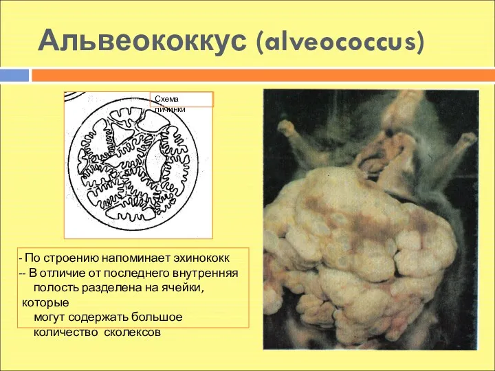 Альвеококкус (alveococcus) По строению напоминает эхинококк - В отличие от