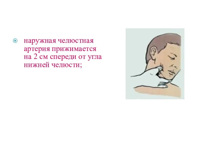 наружная челюстная артерия прижимается на 2 см спереди от угла нижней челюсти;