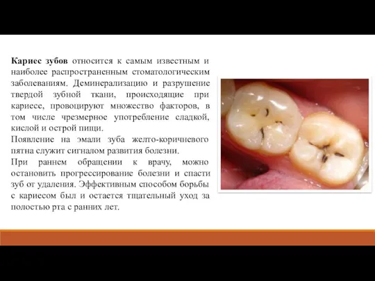 Кариес зубов относится к самым известным и наиболее распространенным стоматологическим