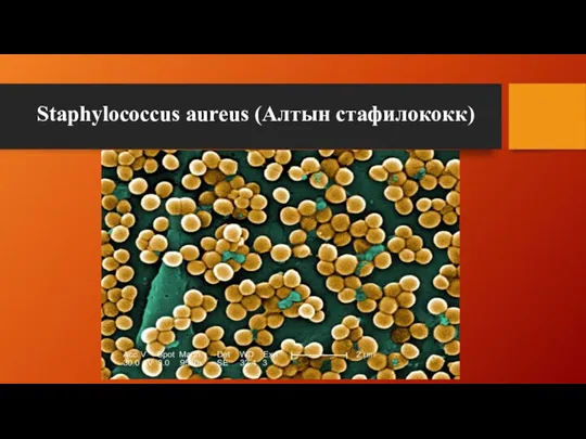 Staphylococcus aureus (Алтын стафилококк)