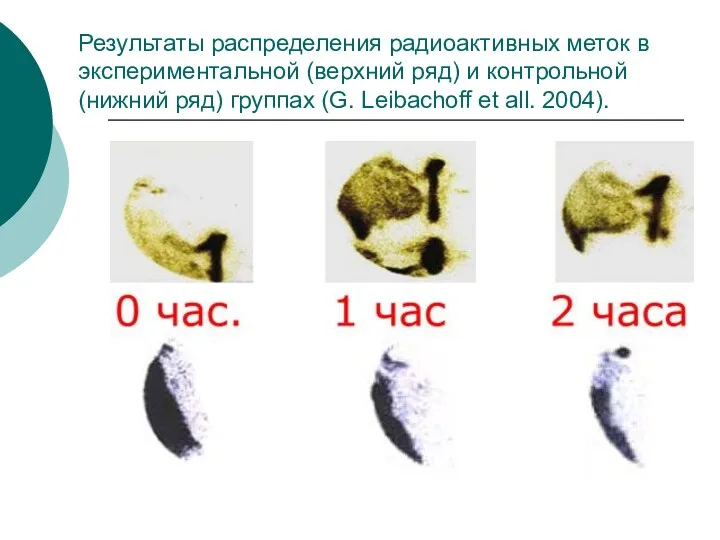 Результаты распределения радиоактивных меток в экспериментальной (верхний ряд) и контрольной