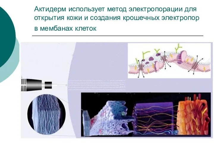 Актидерм использует метод электропорации для открытия кожи и создания крошечных электропор в мембанах клеток