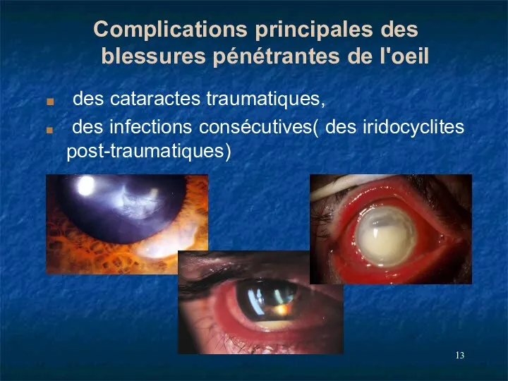 Complications principales des blessures pénétrantes de l'oeil des cataractes traumatiques, des infections consécutives( des iridocyclites post-traumatiques)