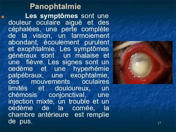 Panophtalmie Les symptômes sont une douleur oculaire aiguë et des