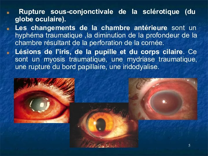 Rupture sous-conjonctivale de la sclérotique (du globe oculaire). Les changements