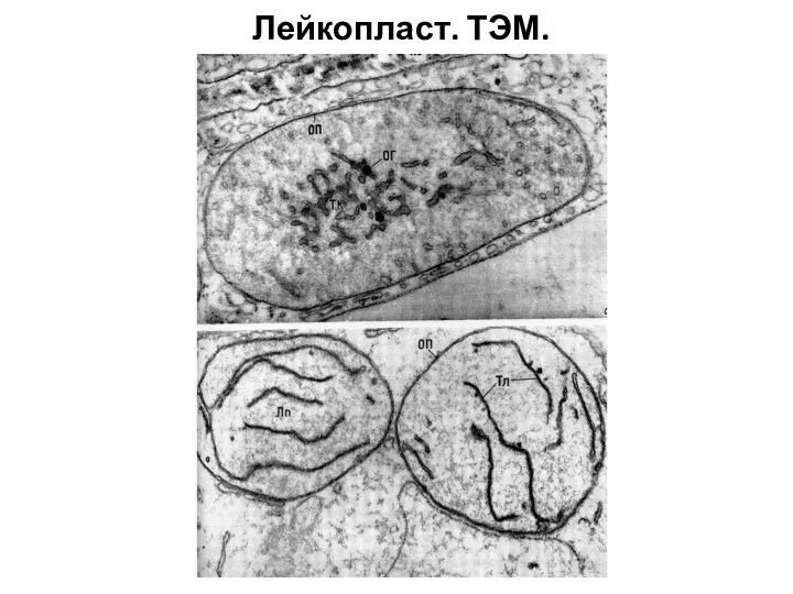 Лейкопласт. ТЭМ.