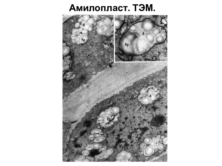 Амилопласт. ТЭМ.