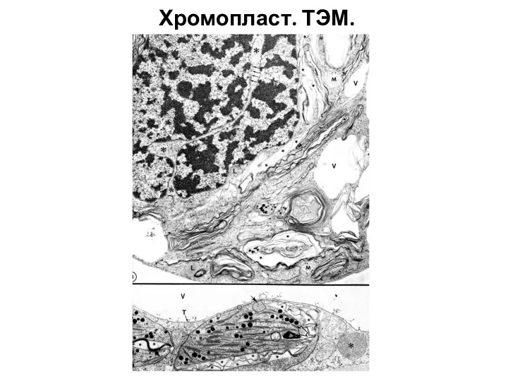 Хромопласт. ТЭМ.