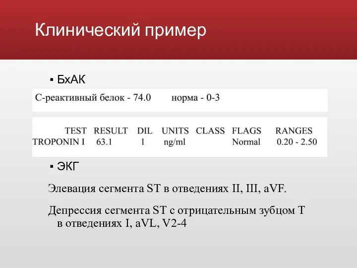 Клинический пример БхАК ЭКГ Элевация сегмента ST в отведениях II,