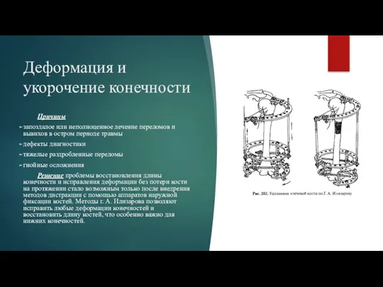 Деформация и укорочение конечности Причины запоздалое или неполноценное лечение переломов