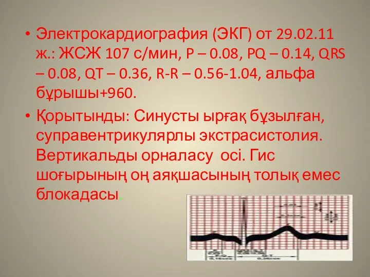 Электрокардиография (ЭКГ) от 29.02.11ж.: ЖСЖ 107 с/мин, P – 0.08, PQ – 0.14,
