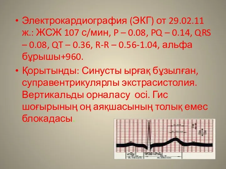 Электрокардиография (ЭКГ) от 29.02.11ж.: ЖСЖ 107 с/мин, P – 0.08,