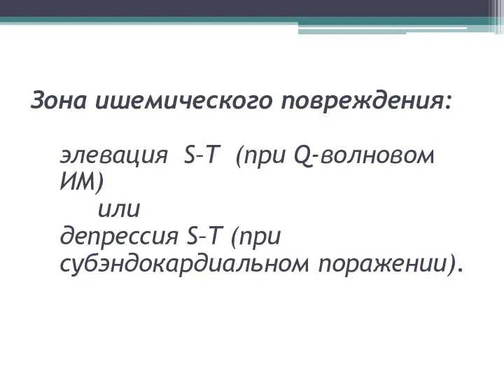 Зона ишемического повреждения: элевация S–T (при Q-волновом ИМ) или депрессия S–T (при субэндокардиальном поражении).