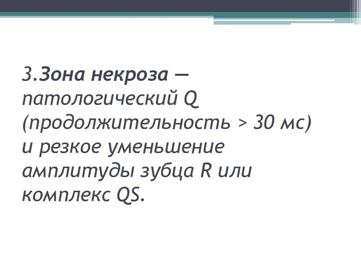 3.Зона некроза — патологический Q (продолжительность > 30 мс) и