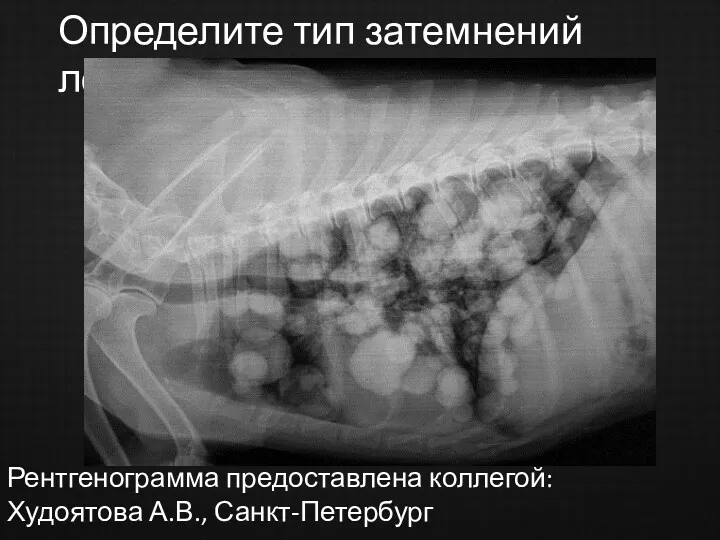 Определите тип затемнений лёгких Рентгенограмма предоставлена коллегой: Худоятова А.В., Санкт-Петербург