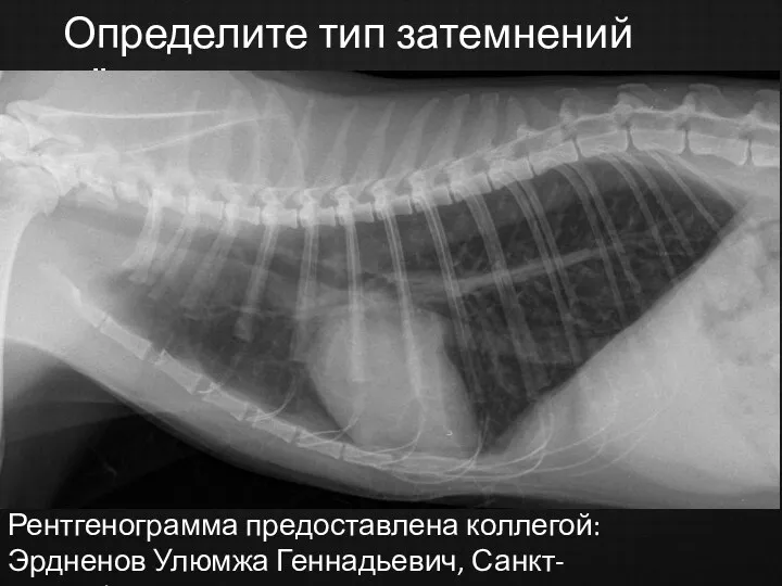 Определите тип затемнений лёгких Рентгенограмма предоставлена коллегой: Эрдненов Улюмжа Геннадьевич, Санкт-Петербург