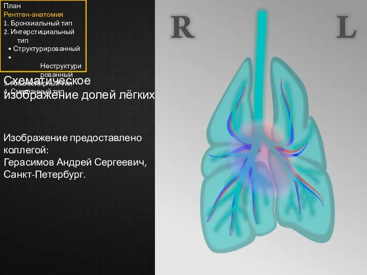 Схематическое изображение долей лёгких. Изображение предоставлено коллегой: Герасимов Андрей Сергеевич, Санкт-Петербург. План Рентген-анатомия