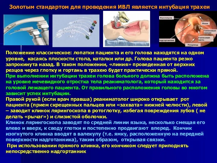 Золотым стандартом для проведения ИВЛ является интубация трахеи Положение классическое: