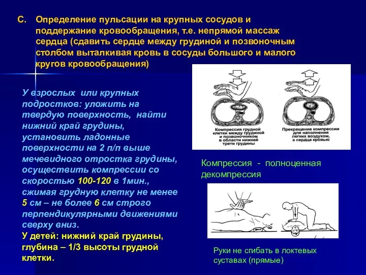 Определение пульсации на крупных сосудов и поддержание кровообращения, т.е. непрямой