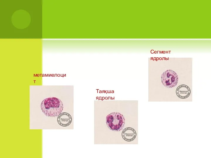 метамиелоцит Таяқша ядролы Сегмент ядролы