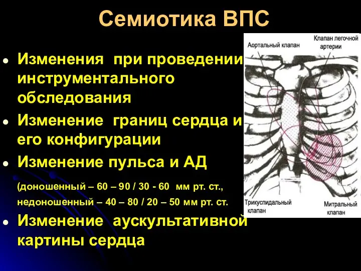 Семиотика ВПС Изменения при проведении инструментального обследования Изменение границ сердца и его конфигурации