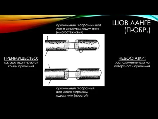 ШОВ ЛАНГЕ (П-ОБР.) ПРЕИМУЩЕСТВО: хорошо адаптируются концы сухожилия НЕДОСТАТКИ: расположение